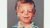 Deca i Tričer Kolinsov sindrom: Dečak kog su roditelji napustili zbog izgleda - Mrzeo sam vlastito lice, ali sada sam ponosan na njega: