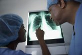 Dijagnostička metoda bez greške otkriva promene na plućima