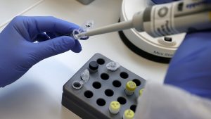 Direktor IZJZ: Institut nikada nije prestajao sa testiranjem, do sada urađeno 3.000 PCR analiza