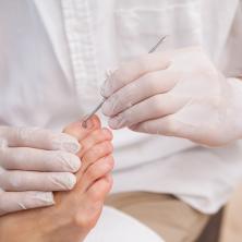 Doktorka HITNE POMOĆI SAVETUJE - Vodite računa o higijeni stopala, posledice mogu biti izuzetno neprijatne
