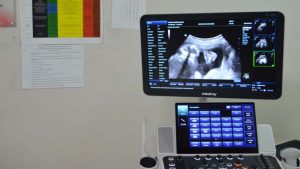 Domu zdravlja u Boru ultrazvučni aparat najnovije generacije