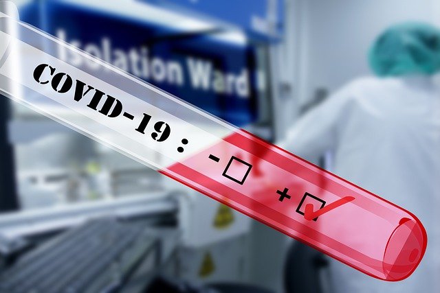 E-uprava omogućila elektronsko zakazivanje termina za PCR testiranje na lični zahtev