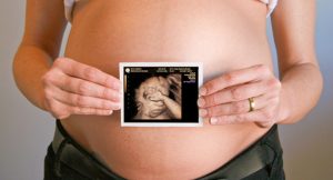 Edukacija trudnica o gestacijskom dijabetesu od danas u Almaškoj 4