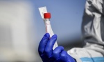 Epidemija hara Francuskom: Preminuli od virusa korona premašili bilans od 500 na dnevnom nivou