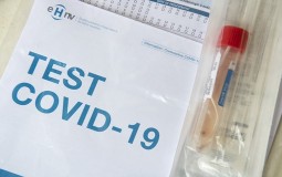 
					Epidemiolog Radovanović: Navodno slabljenje koronavirusa je grdna zabluda 
					
									