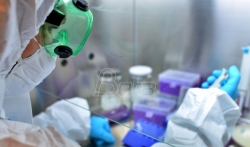 Fond za nauku: Srpski naučnici razvijaju brže antigenske testove i lek protiv kovid-19