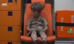 Fotograf: Omran simbol patnje dece u Alepu 