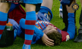 Fudbaler Barselone pogođen loptom u glavu – prevezen u bolnicu FOTO
