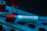 Glavni američki epidemiolog: Ozbiljno sumnjam u rusku vakcinu