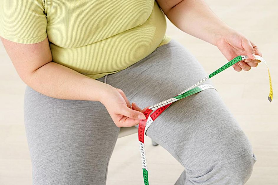 Gojaznost je krivac za više od 200 bolesti: Gojaznima zato ne nudimo vitkost i sreću već poboljšanje zdravlja