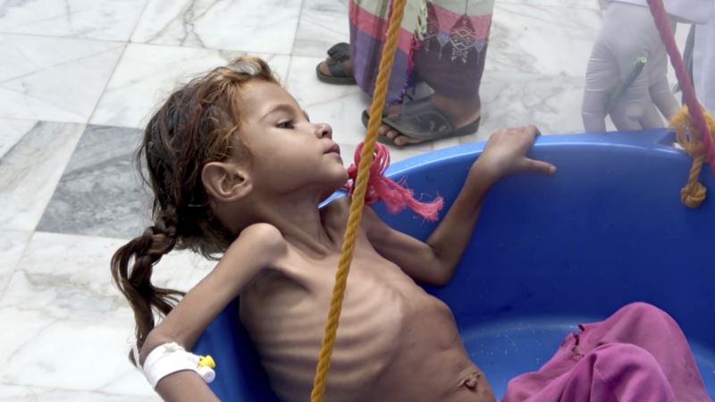 Gutereš upozorava na glad u Jemenu, poziva na obustavu nasilja 