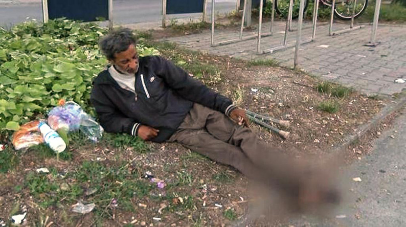 HOROR: Bespomoćan čovek 6 meseci živi na travnjaku u Skoplju i moli za pomoć, dok mu se stopala raspadaju (UZNEMIRUJUĆE FOTOGRAFIJE)