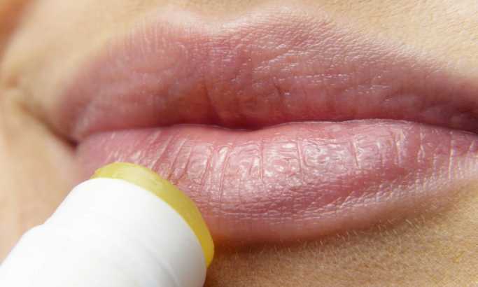 Herpes: Tri saveta za sprečavanje ranica oko usana