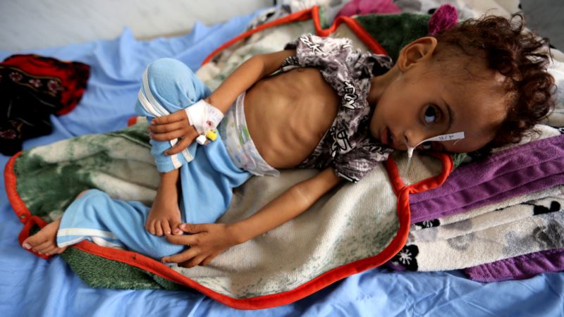 Hiljade dece umrle od gladi u Jemenu