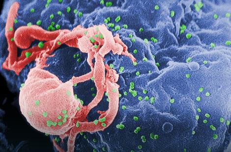 IMUNOTERAPIJA Lekovima za rak protiv virusa HIV