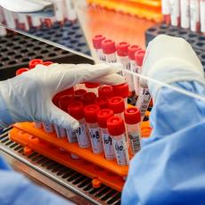 IZUZETNI REZULTATI NAŠEG ZDRAVSTVA: U Srbiji PCR test za 24 sata, u drugim zemljama i duže od nedelju dana