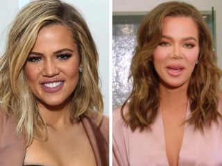 „Imala si treću transplantaciju lica“: Khloe Kardashian priznala da je operisala nos