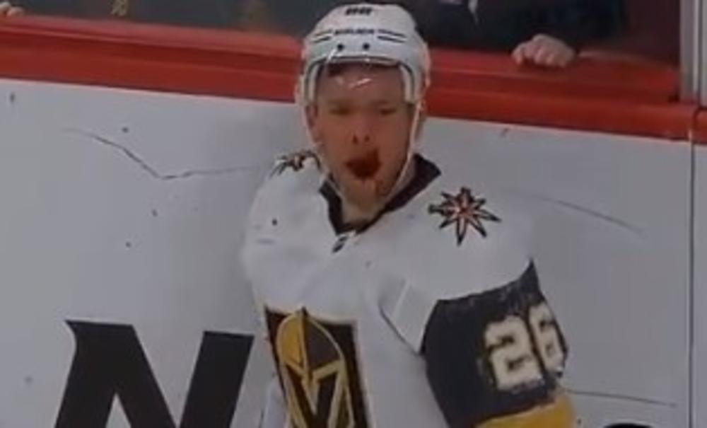 JEZIVA SCENA U NHL LIGI: Hokejašu šikljala krv iz usta dok je ZUBE skupljao po ledu! (UZNEMIRUJUĆI VIDEO