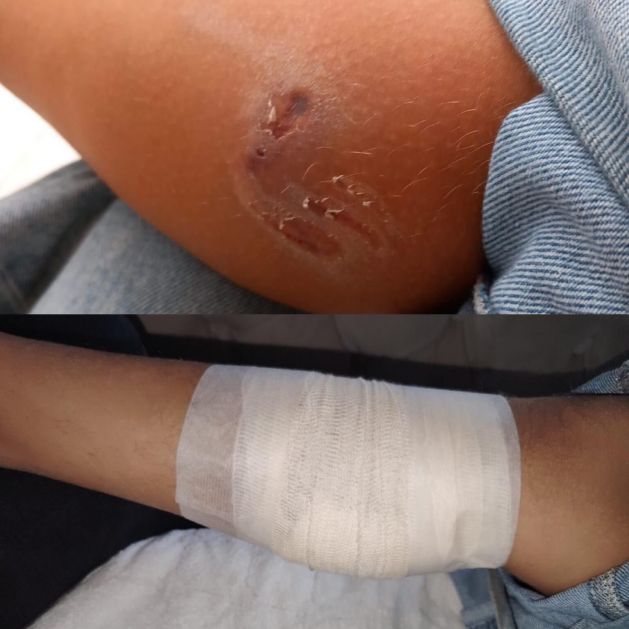 Još jedan napad psa na dijete u Novom Pazaru, od azila još uvek ništa (VIDEO)