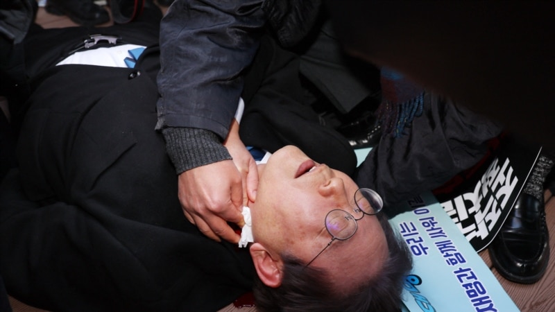 Južnokorejski opozicioni lider se oporavlja posle napada nožem 
