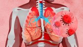 Korona virus: Kako Kovid-19 utiče na kardiovaskularni i respiratorni sistem u telu