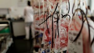 Korona virus i lečenja: Šta je ozoniranje krvi i da li je opasno, objašnjavaju lekari