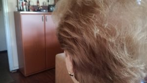 Korona virus i opadanje kose: „Samo da ne oćelavim i ne nosim periku“
