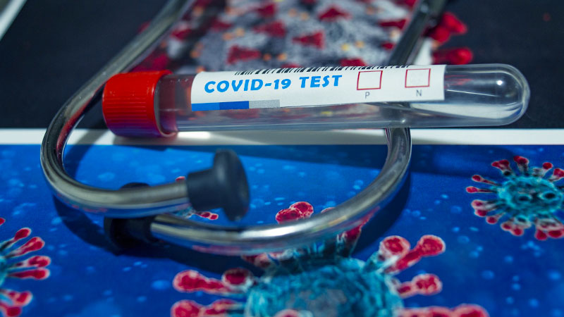 Koronavirus u Boru: Oporavilo se još 10 osoba, 13 novozaraženih