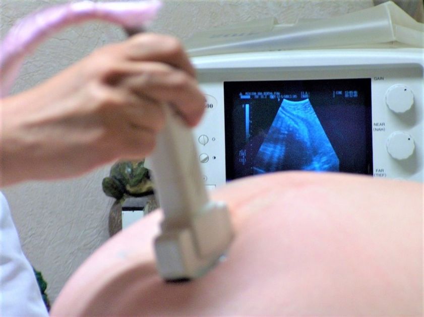 Kovid ambulanta za zaražene trudnice u Novom Sadu