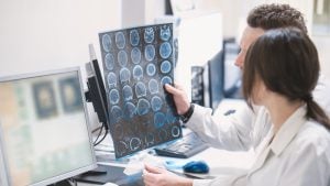 Kreatin može pomoći kod Alchajmera, pokazuje nova studija
