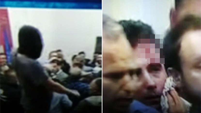 Krvave glave na sve strane: Opšti haos u Makedoniji, batine dobio i Zoran Zaev (UZNEMIRUJUĆI FOTO)