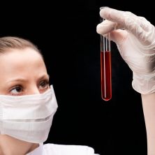 Krvna SLIKA NIJE DOBRA ukoliko POKAZUJE ove VREDNOSTI: Evo kako da TUMAČITE NALAZ, najbitniji parametri