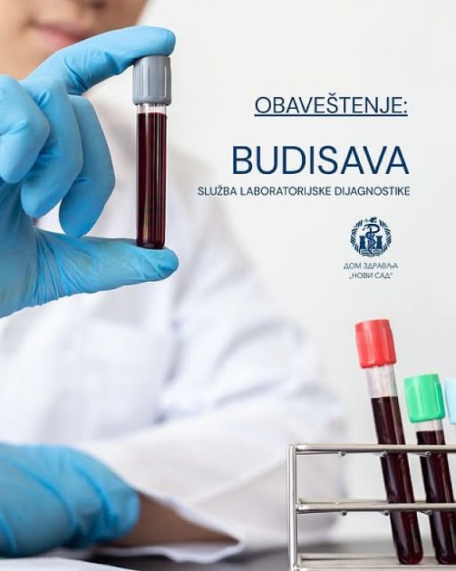 Laboratorija u Budisavi u četvrtak neće raditi