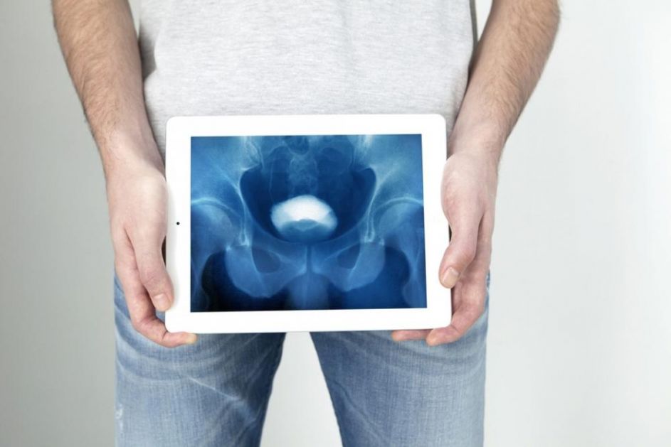 Laserska hirurgija – pravi izbor za muškarca s uvećanom prostatom