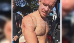Lekar u Australiji udario ajkulu pesnicom u nos i odbranio se