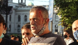 Trifunović (PSG): Protest su uzurpirali fašisti i razne vrste desničara (VIDEO)