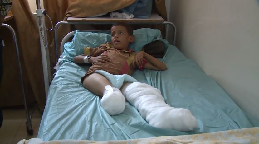 MALIŠAN U VIHORU RATA: Gluvonemi dečak objašnjava kako je u bombardovanju izgubio nogu (VIDEO)