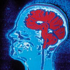 MEMORIJSKE PROTEZE: Pomoću čipova u mozgu poboljšavaće pamćenje ljudi!