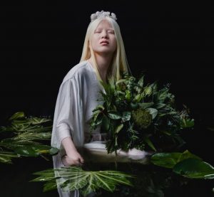 Manekenstvo: Šuli Ebing – napuštena albino beba postala vrhunski model i želi da promeni svet