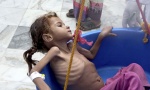 Milioni u Jemenu na ivici gladi
