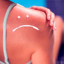 Mit o tamnjenju kao zaštiti od sunčanih opekotina - Dermatolog OTKRIVA pravilnu zaštitu od sunca