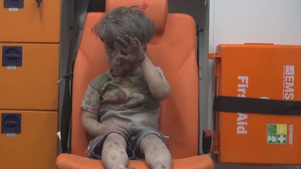 Moskva odbacuje optužbe za napade u kojima je povređen dečak iz Sirije