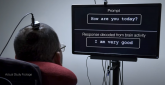 Moždani implant omogućio paralizovanom čoveku da izgovori cele rečenice VIDEO