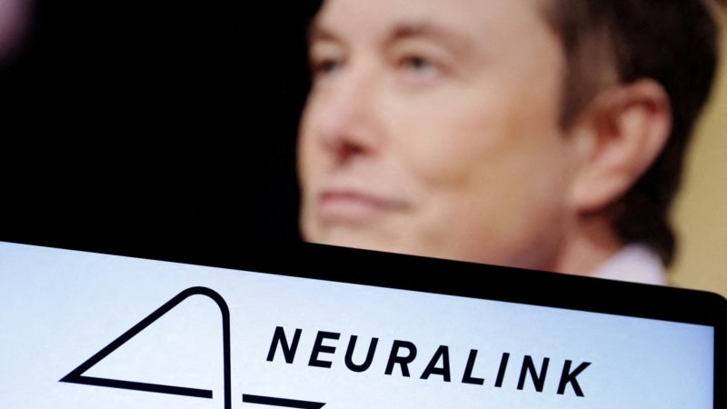 Muskov Neuralink dobio odobrenje za proučavanje moždanih implantata na ljudima