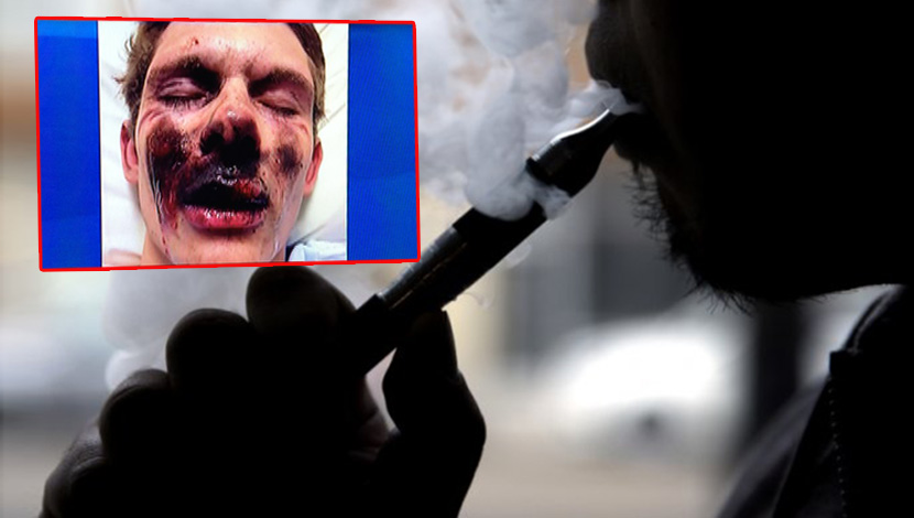 NAUČNO DOKAZANO: Elektronska cigareta izaziva STAVIČNU neizlečivu bolest zvanu “kokičasta pluća”!