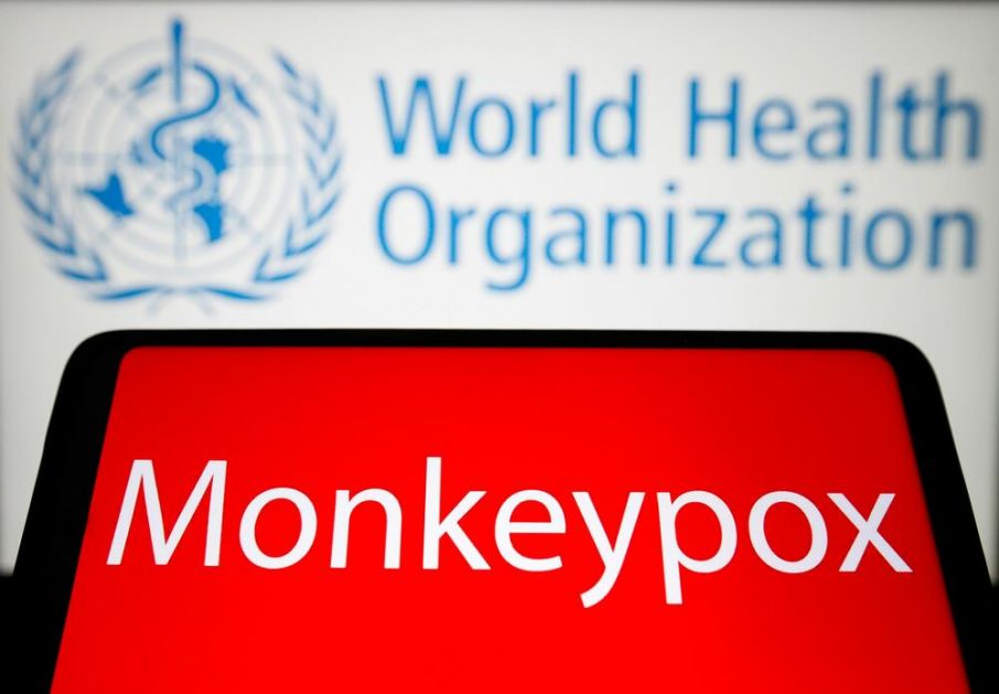 NEMA RIZIKA OD PANDEMIJE? SZO potvrdila 80 slučajeva majmunskih boginja u 11 zemalja