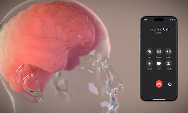 NEURALINK PLANIRA TEST IMPLANTATA ZA GOVOR: Hoće li moždani implanti više ličiti na utopijsku ili distopijsku naučnu fantastiku?