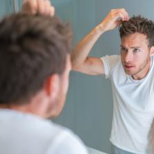 NI MLAĐI NISU IZUZETI: Evo koji faktori utiču na to da kosa PRERANO OSEDI!