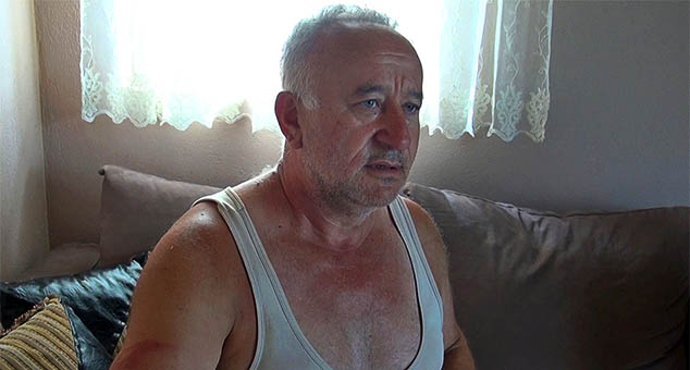 Napadnut i teško pretučen Srbin povratnik kada je pokušao da zaštiti imovinu (FOTO)