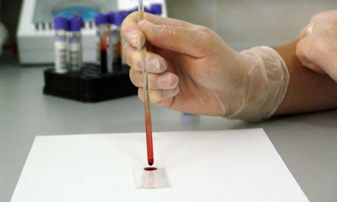 Naučnici stvorili revolucionarni test krvi koji otkriva boju bola
